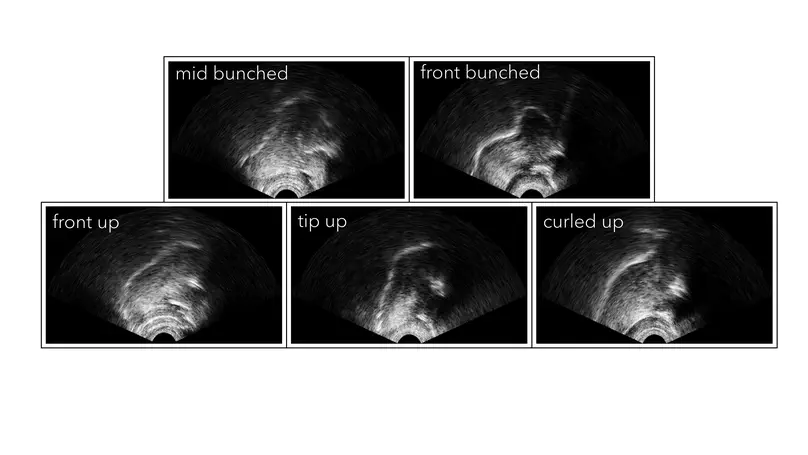 Loose lips and tongue tips: The central role of the /r/-typical labial gesture in Anglo-English